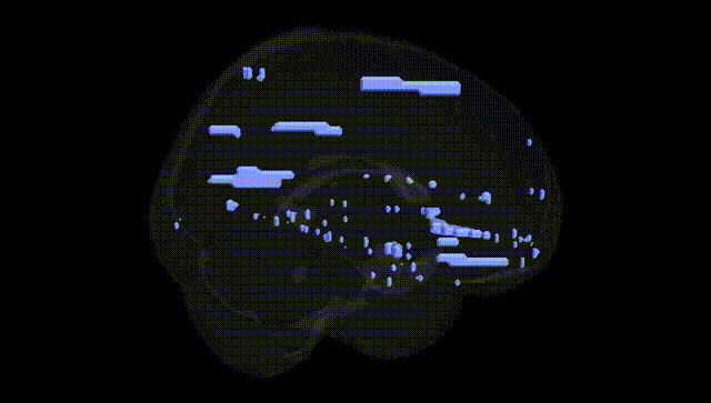 Full Brain Black