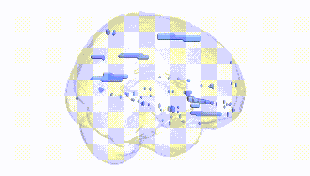 Full Brain White