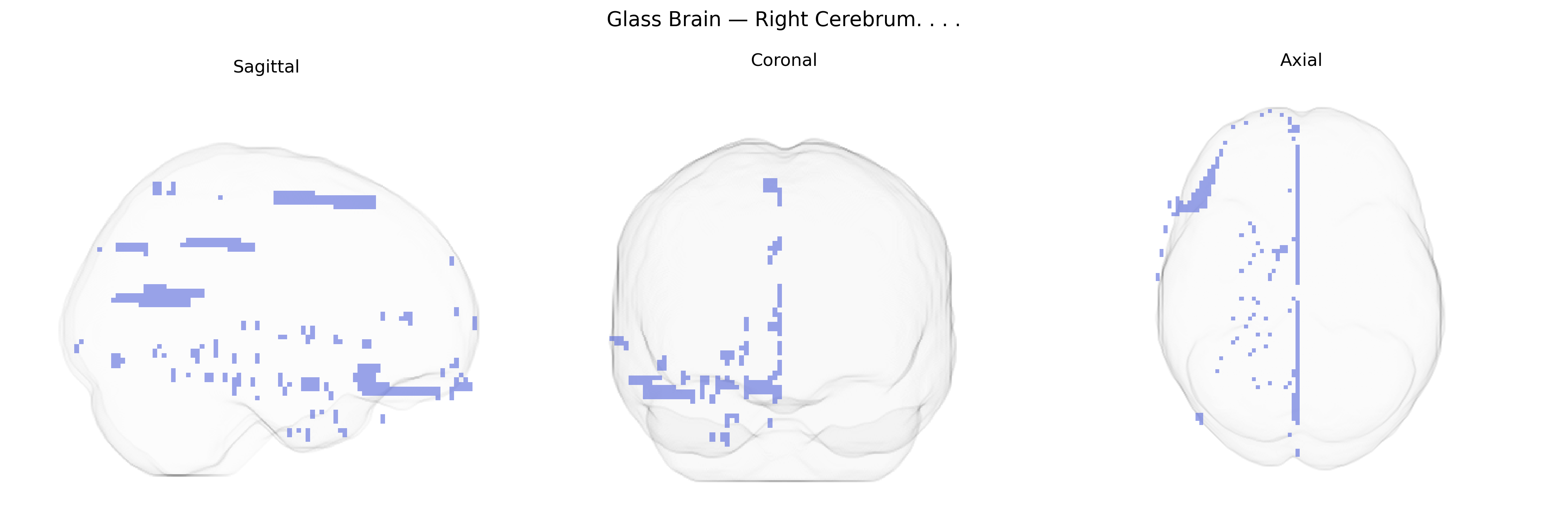 Triplanar Ghost Brain
