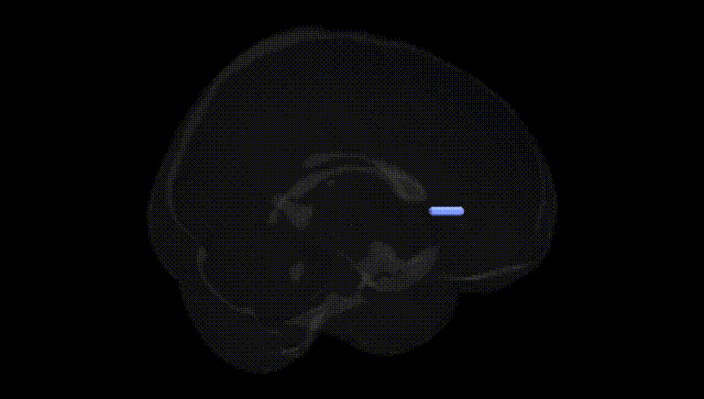 Full Brain Black