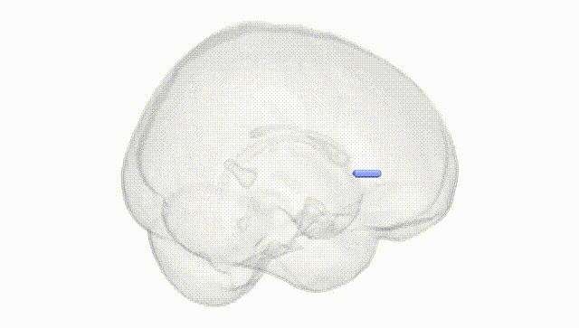 Full Brain White