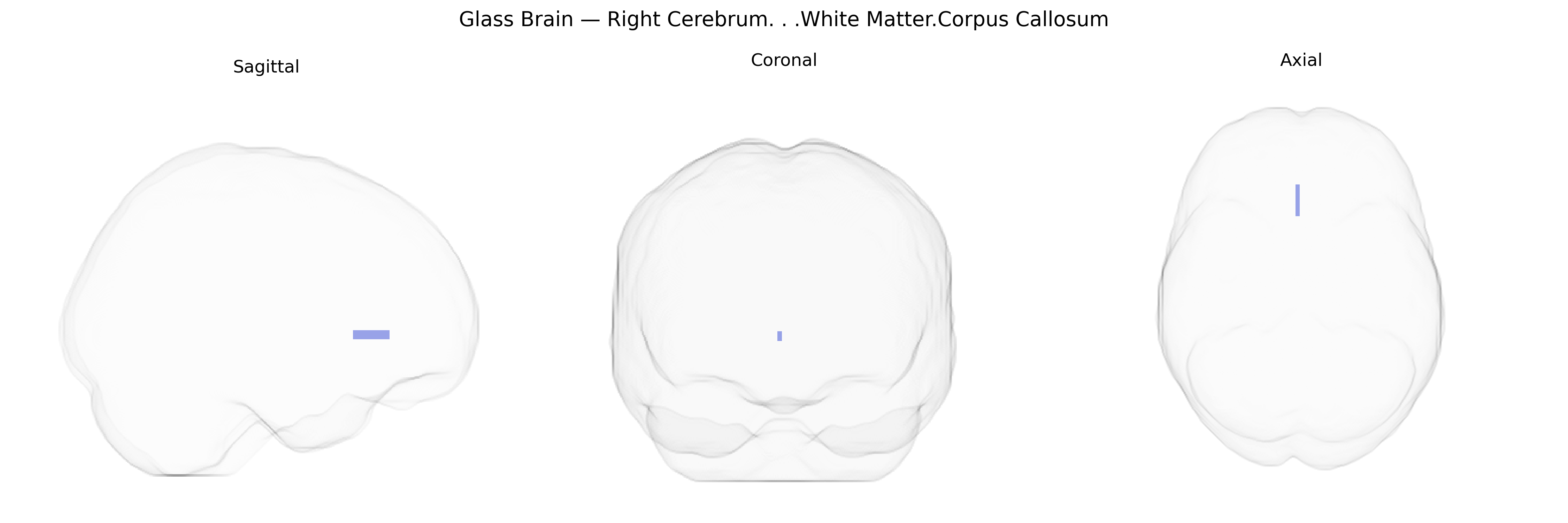 Triplanar Ghost Brain