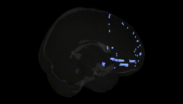 Full Brain Black