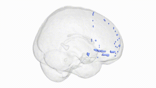 Full Brain White