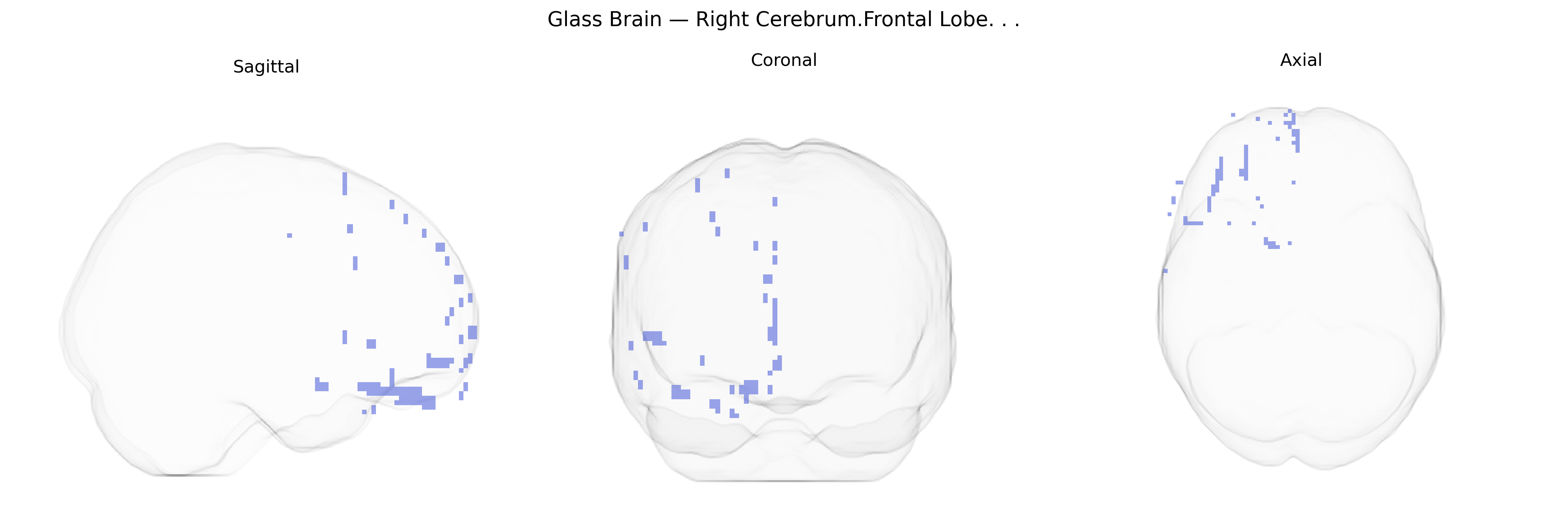 Triplanar Ghost Brain