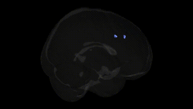 Full Brain Black