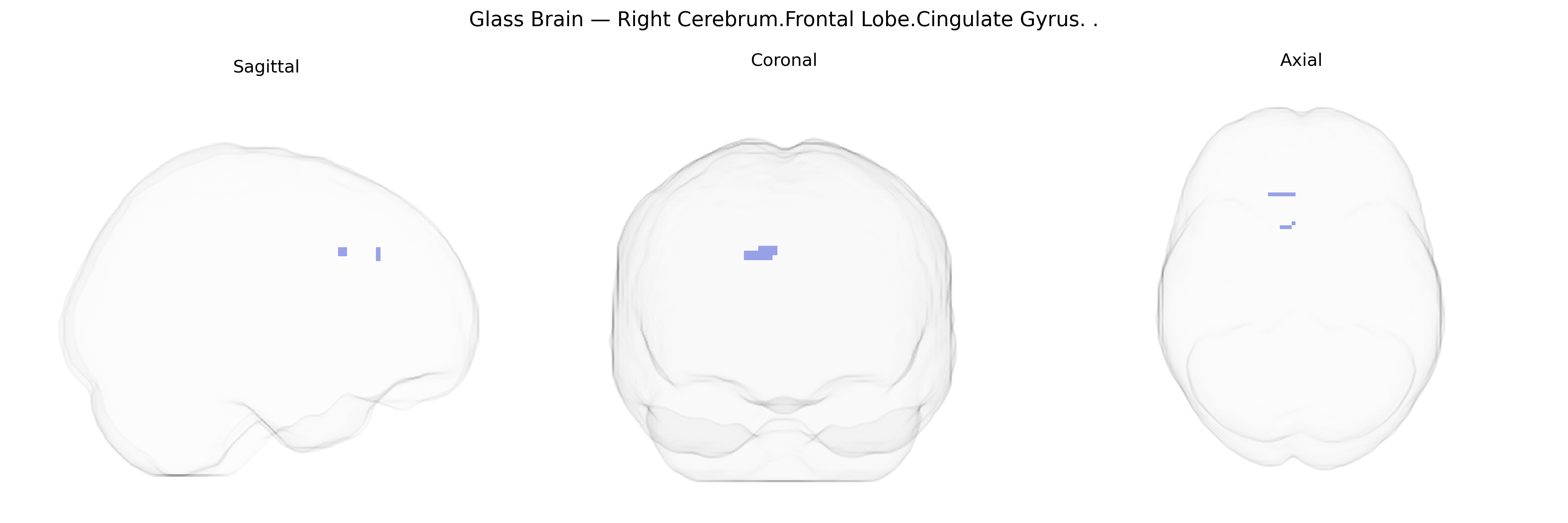 Triplanar Ghost Brain
