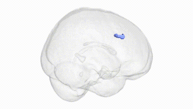 Full Brain White