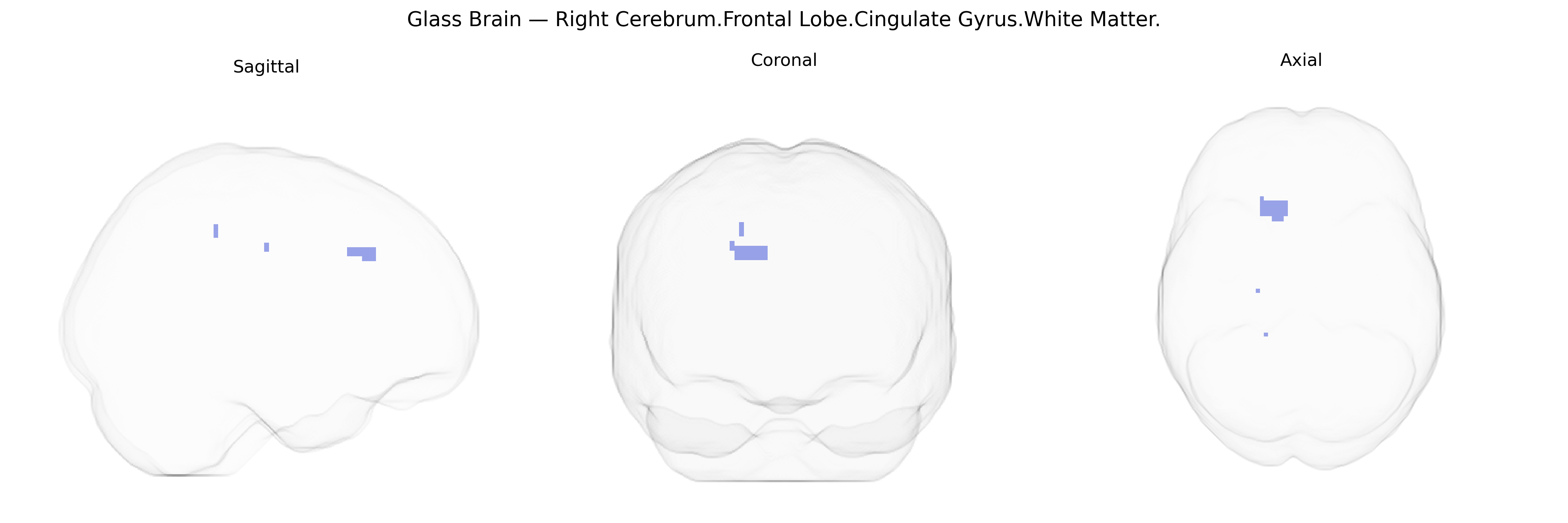 Triplanar Ghost Brain