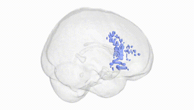 Full Brain White