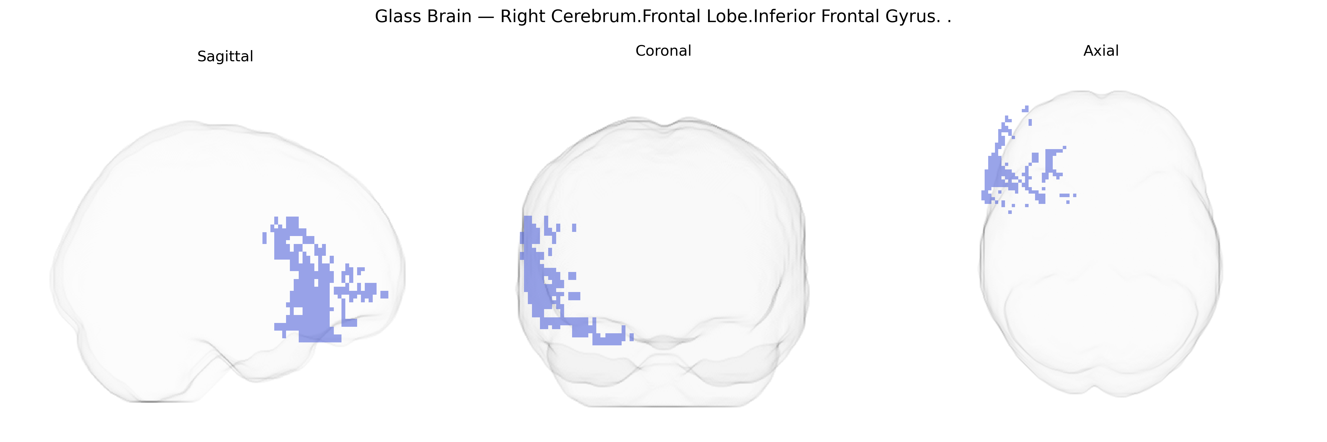 Triplanar Ghost Brain