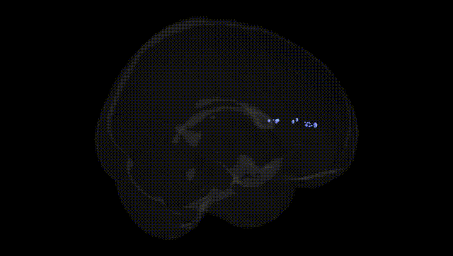 Full Brain Black