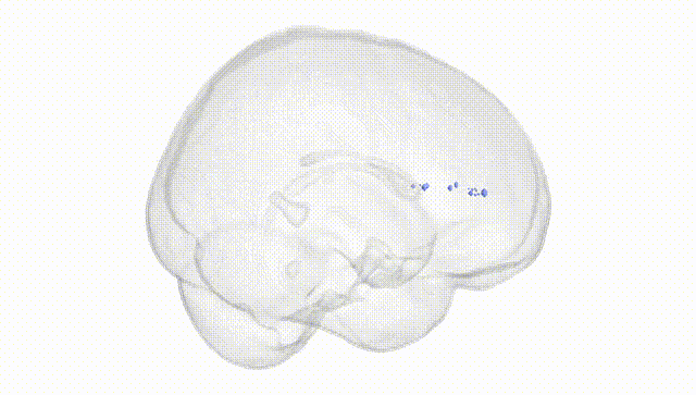 Full Brain White