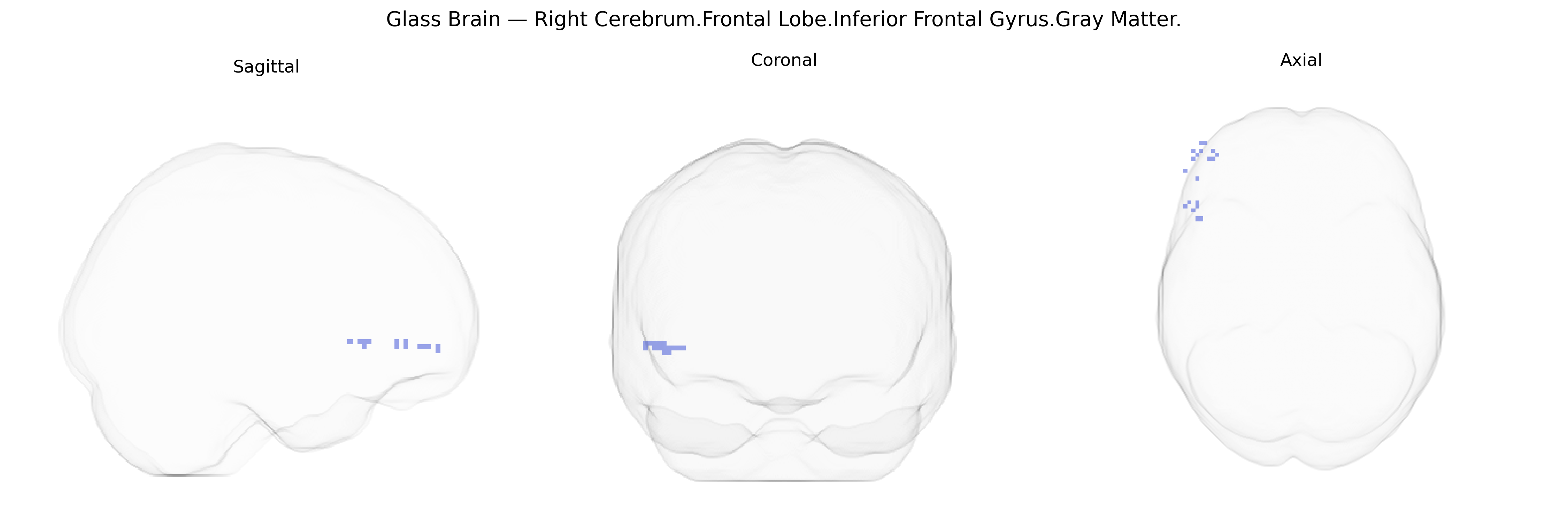 Triplanar Ghost Brain
