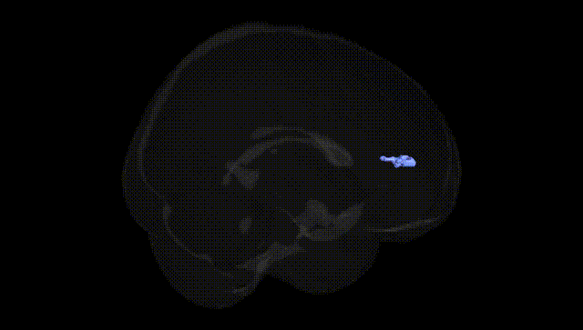 Full Brain Black