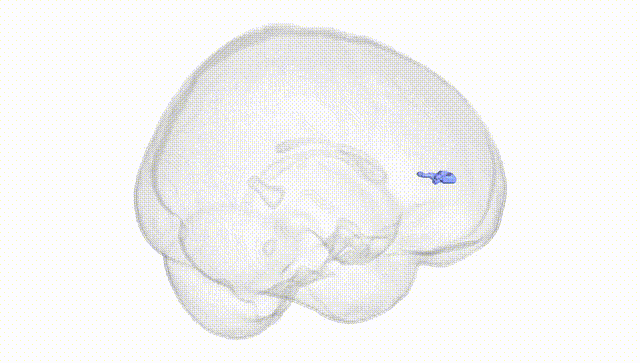 Full Brain White