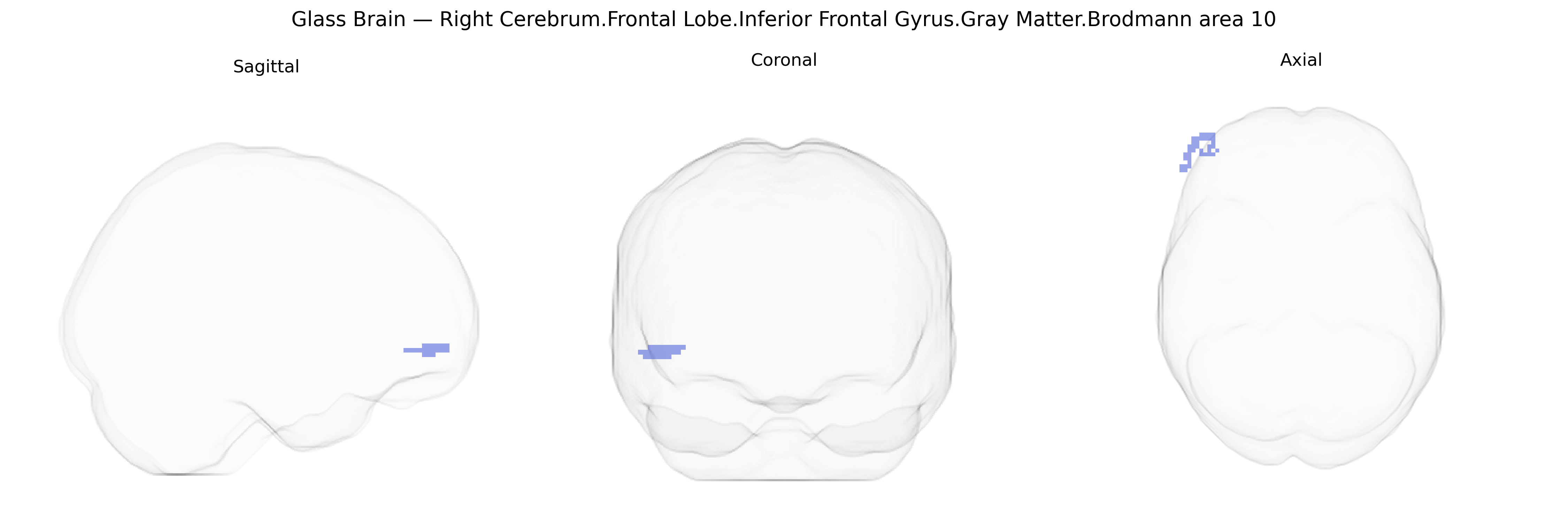 Triplanar Ghost Brain