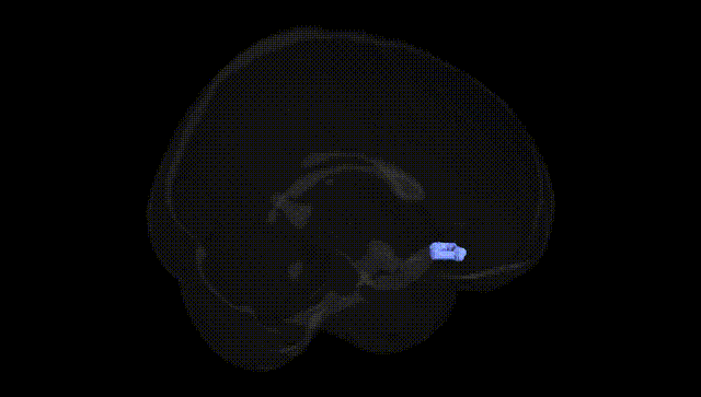 Full Brain Black