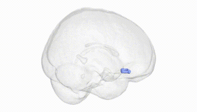 Full Brain White