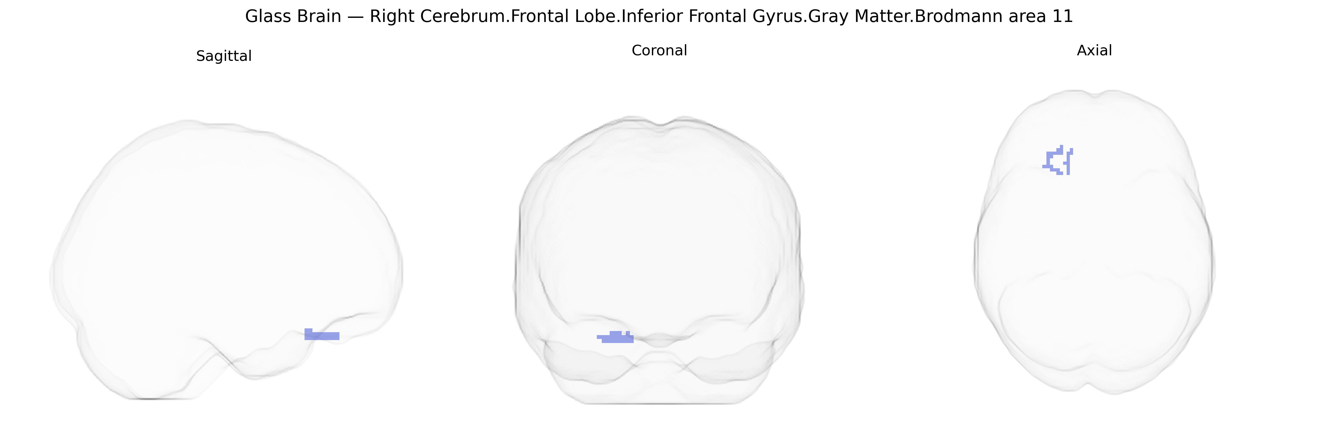 Triplanar Ghost Brain