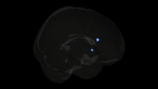 Full Brain Black