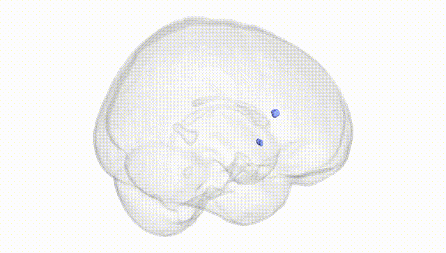 Full Brain White