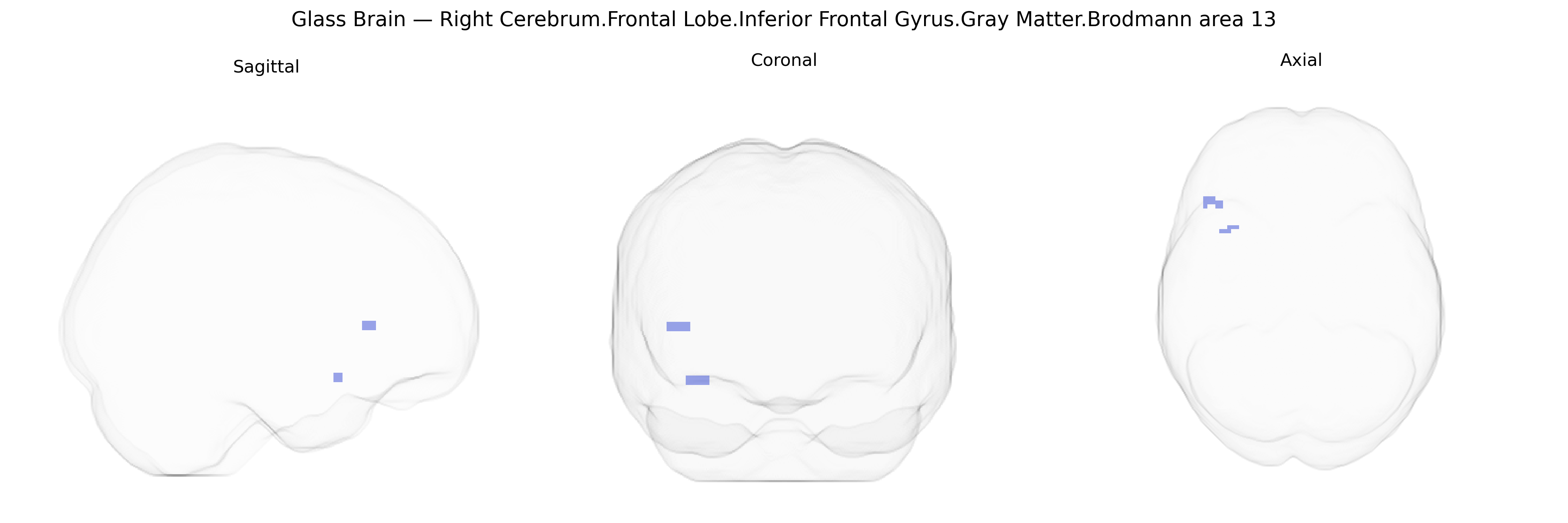 Triplanar Ghost Brain