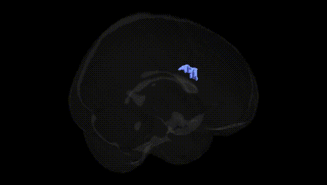 Full Brain Black