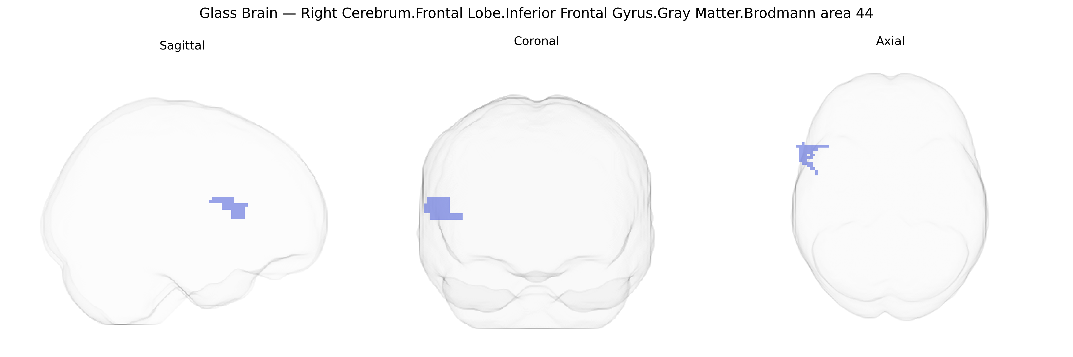 Triplanar Ghost Brain