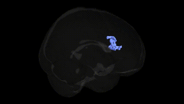 Full Brain Black