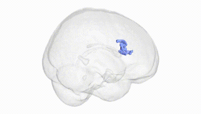 Full Brain White