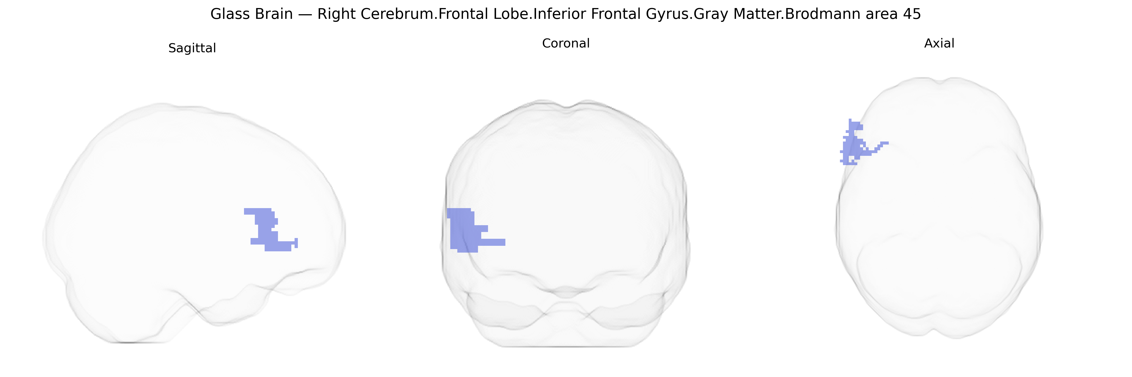 Triplanar Ghost Brain