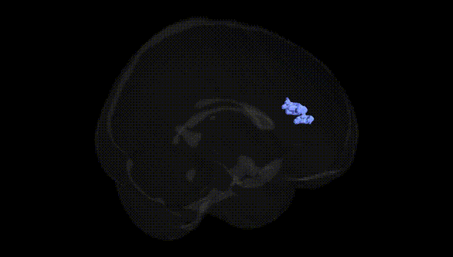 Full Brain Black