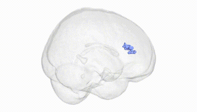 Full Brain White