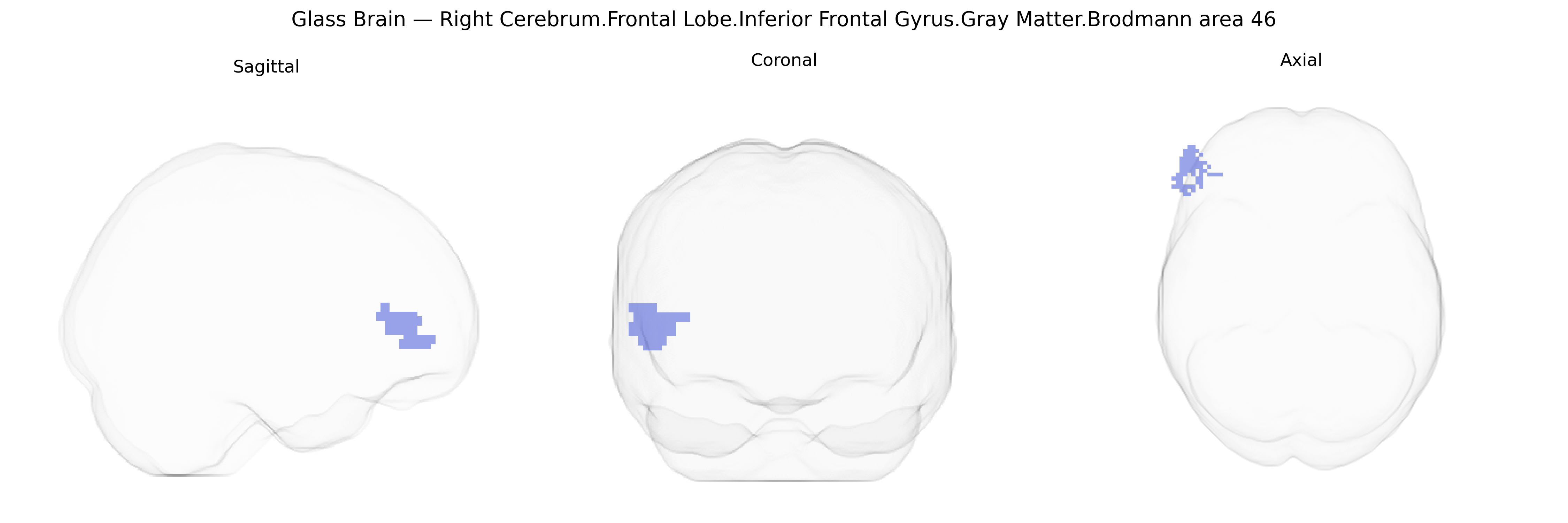 Triplanar Ghost Brain