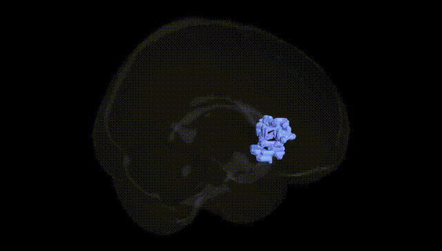 Full Brain Black