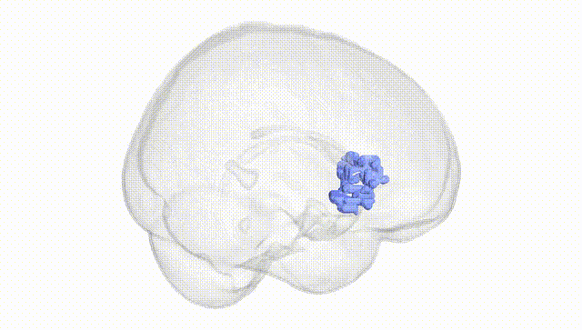 Full Brain White
