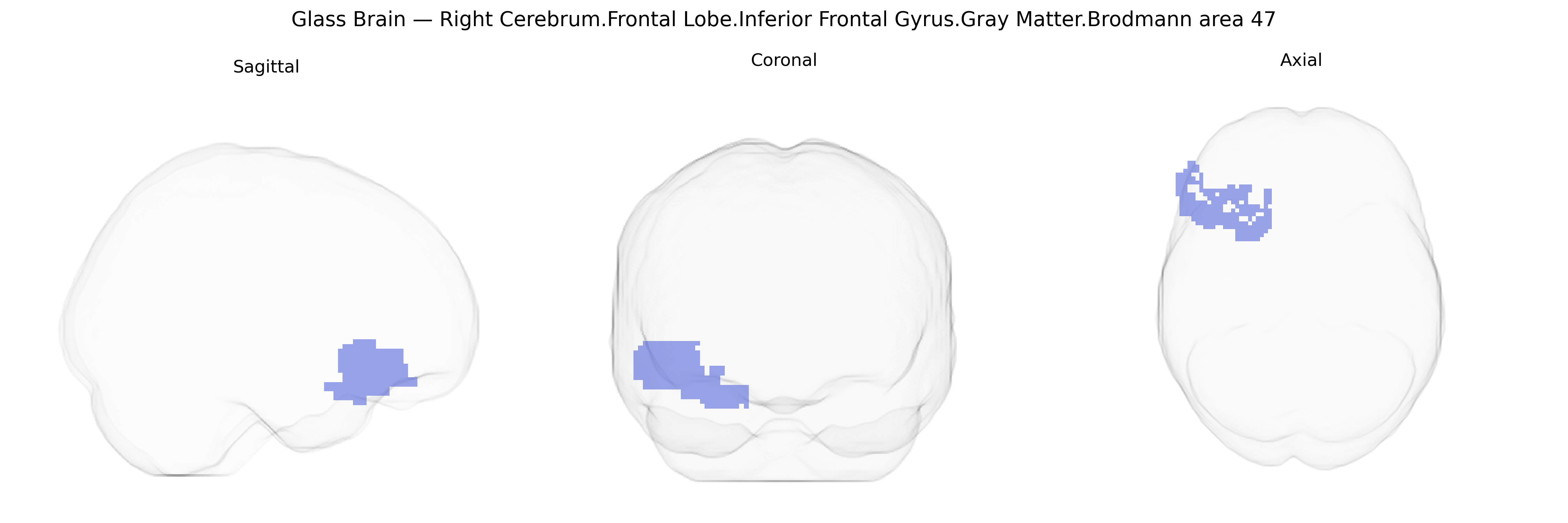 Triplanar Ghost Brain