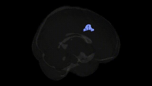 Full Brain Black