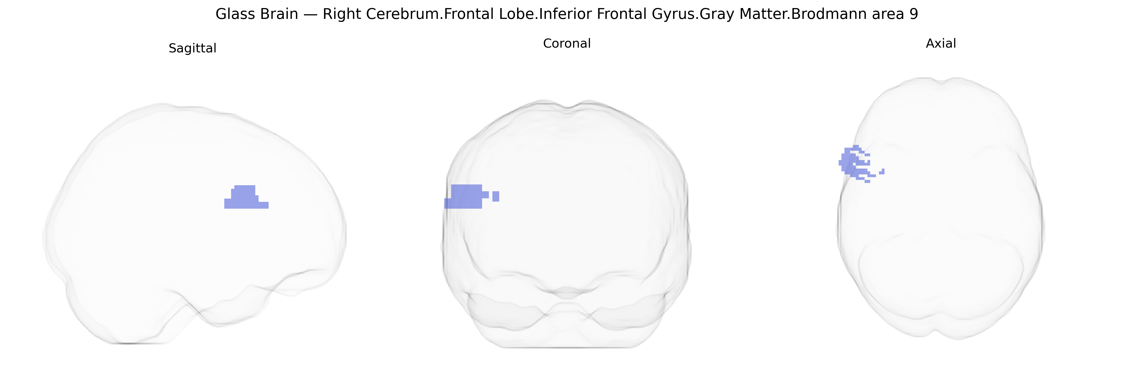 Triplanar Ghost Brain