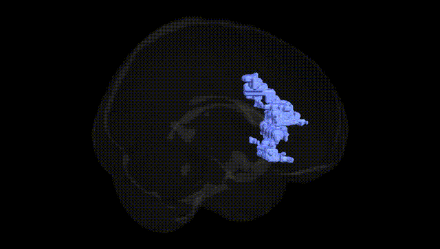 Full Brain Black