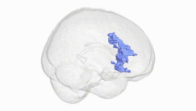 Full Brain White