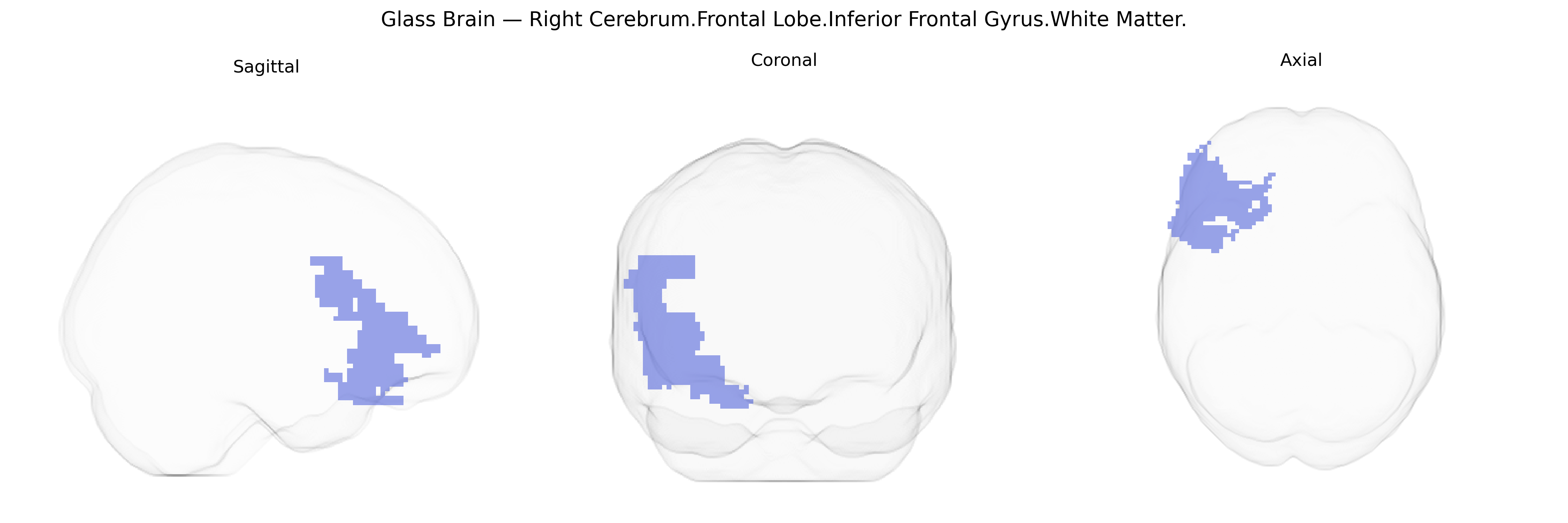 Triplanar Ghost Brain