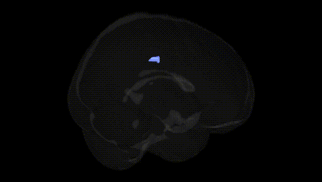Full Brain Black