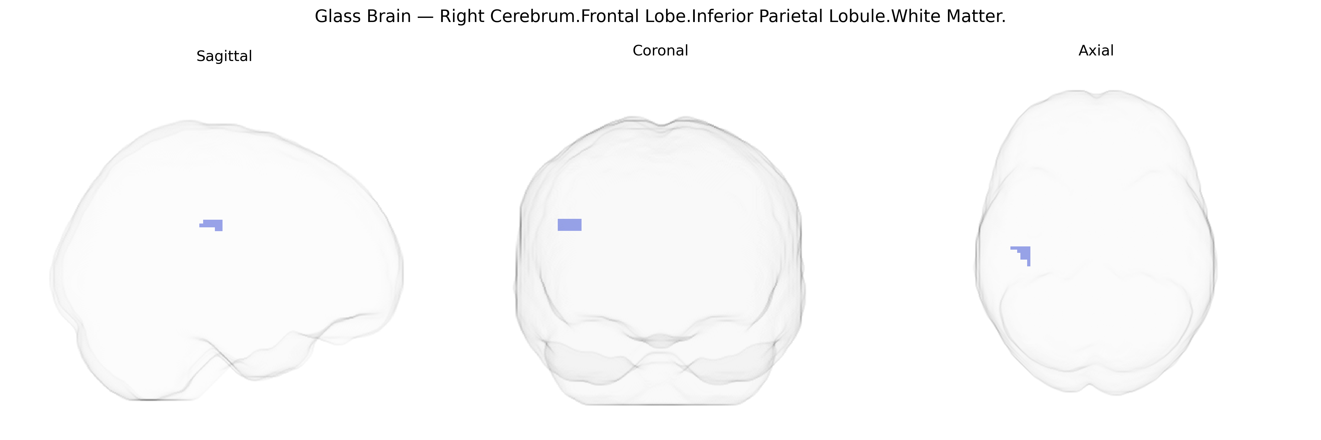Triplanar Ghost Brain