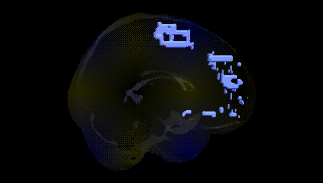 Full Brain Black