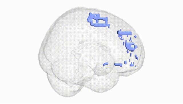 Full Brain White