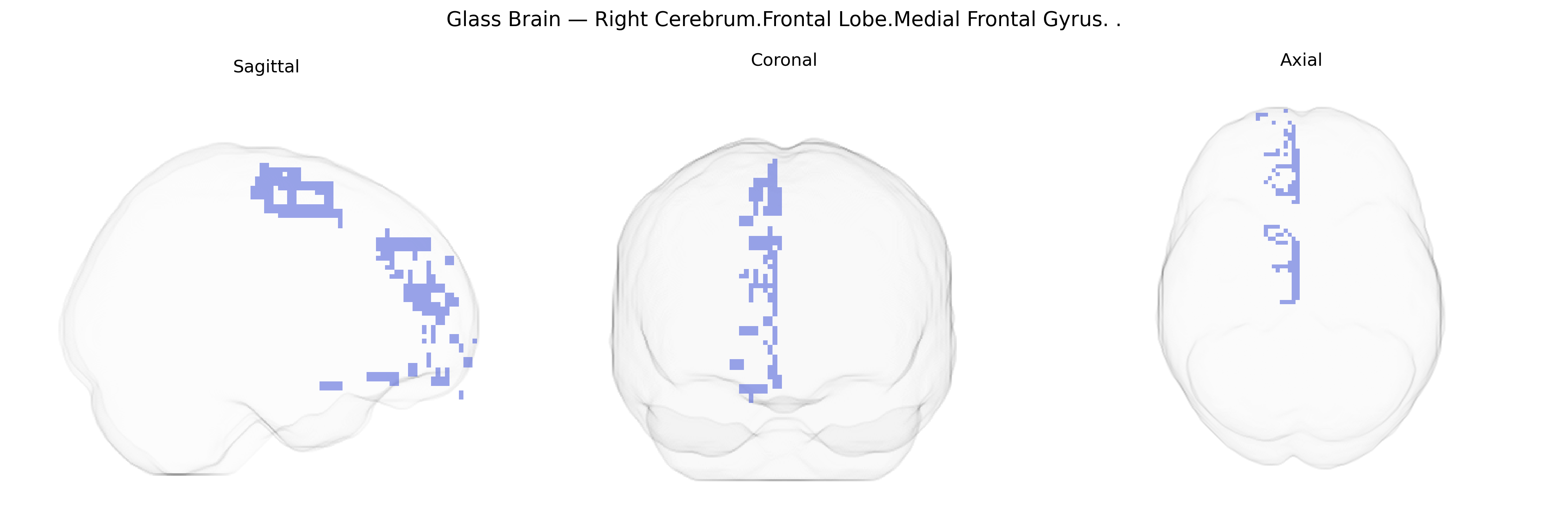 Triplanar Ghost Brain
