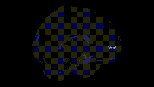 Full Brain Black