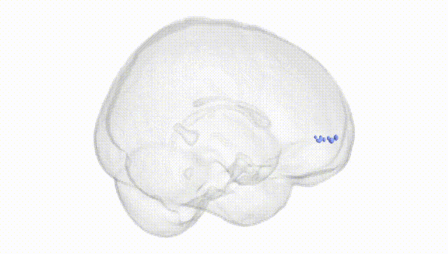 Full Brain White